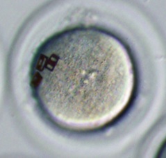 embryo