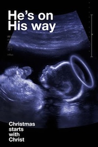 Mary's Ultrasound