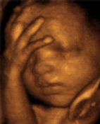 4-D Ultrasound Image